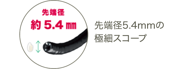 【京都・大宮】にしかわ内科医院で使用する先端径5.4mmの極細スコープ
